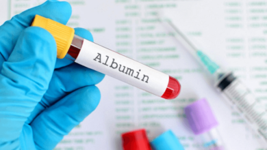 Albumin là gì? Ý nghĩa của việc xét nghiệm chỉ số albumin - AiHealth