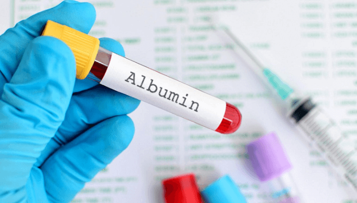 Albumin là gì? Ý nghĩa của việc xét nghiệm chỉ số albumin - AiHealth