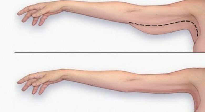 Bắp tay nữ bao nhiêu là đẹp? Số đo chuẩn bắp tay ở nam và nữ