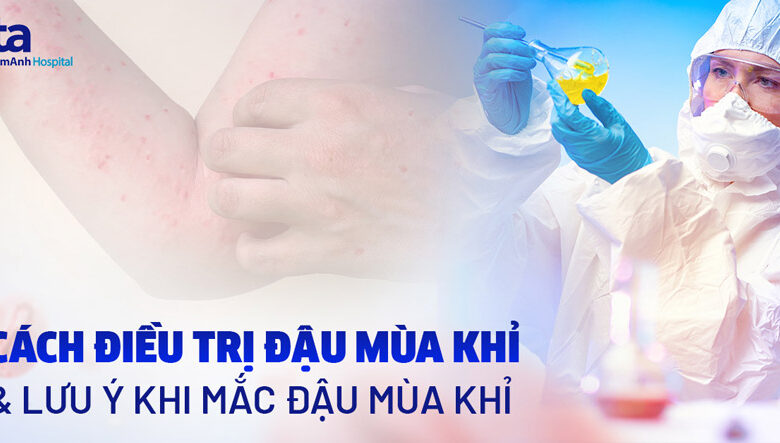 Cách điều trị đậu mùa khỉ? Chẩn đoán & phòng ngừa bệnh ra sao?