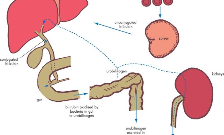 Xét nghiệm bilirubin là gì, có ý nghĩa ra sao | Medlatec