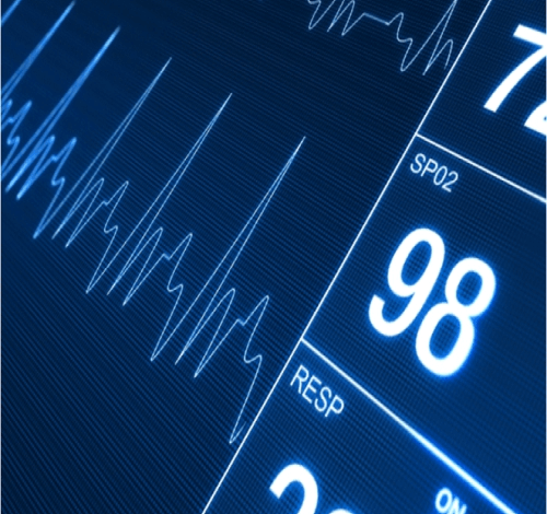 Chỉ số BPM là gì? Có ý nghĩa như nào đối với sức khỏe con người?