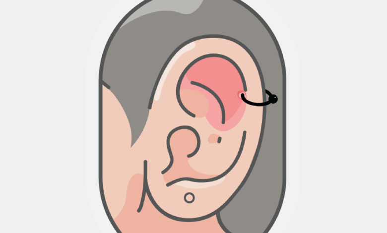 BUMP LỖ TAI LÀ GÌ? NGUYÊN NHÂN VÀ CÁCH XỬ LÝ - Cockstock