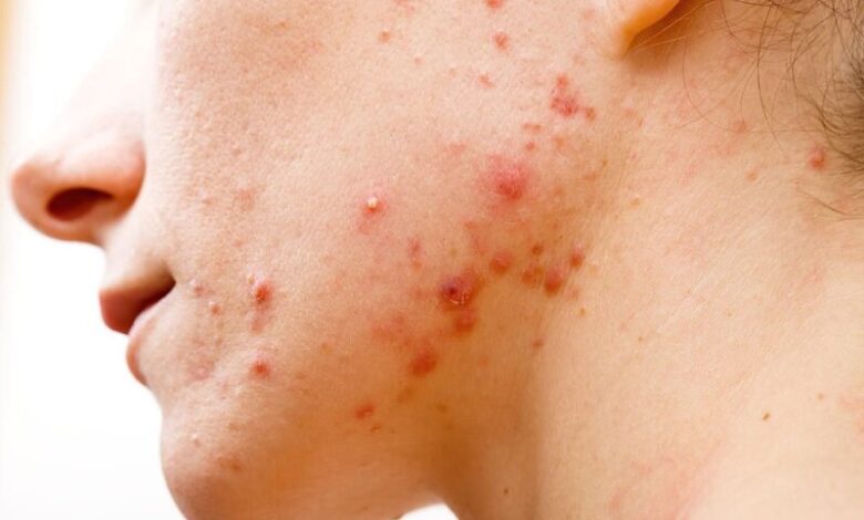 Mách nhỏ các bước chăm sóc da buổi tối đúng chuẩn như spa