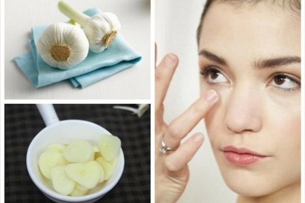10 cách trị mụn tại nhà đơn giản bằng phương pháp tự nhiên