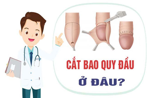 Chi phí cắt bao quy đầu hết bao nhiêu tiền? Bảng giá năm 2023