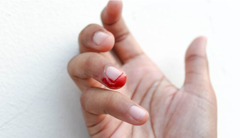 Bấm móng tay sát bị bệnh tim, thực hư ra sao? - Bách hóa XANH
