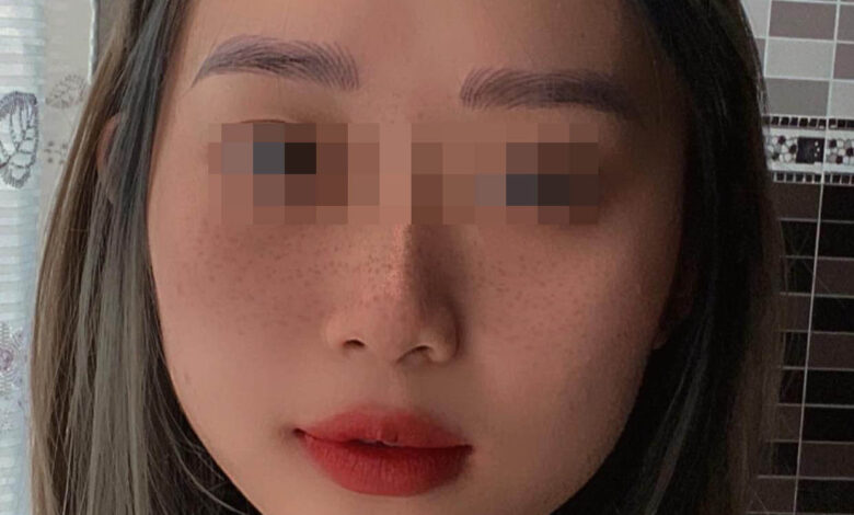 Cấy môi sinh học là gì? Chuyên gia nói gì về phương pháp ... - Eva