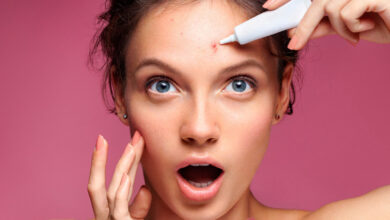 Nên bôi kem trị mụn trước hay sau kem dưỡng để hiệu quả hơn?