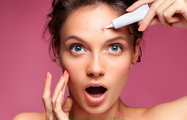 Nên bôi kem trị mụn trước hay sau kem dưỡng để hiệu quả hơn?