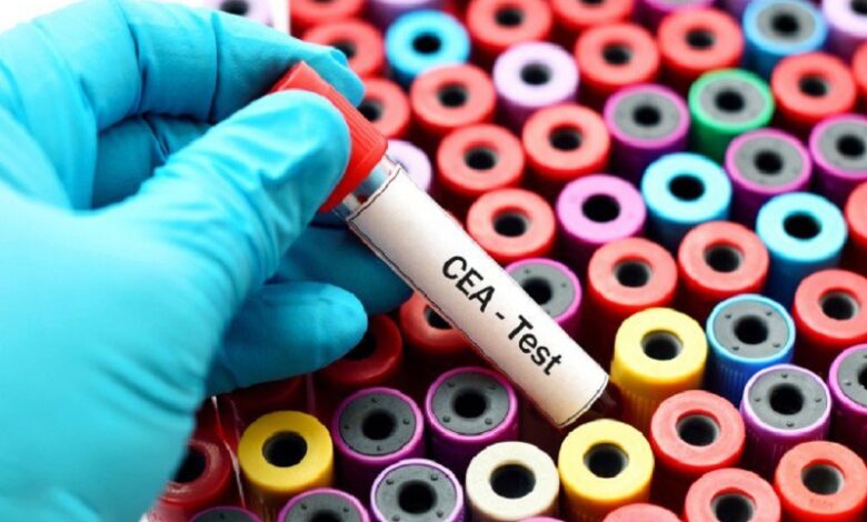 Ý nghĩa của xét nghiệm tầm soát ung thư CEA trong khám chữa bệnh