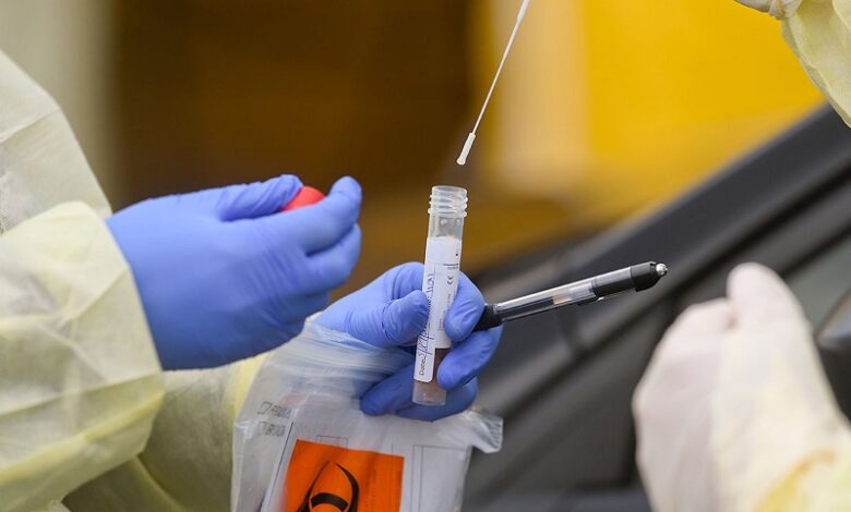 Chỉ số CT Covid là gì và những thông tin liên quan | Medlatec
