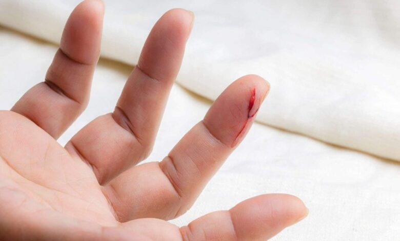 Góc giải đáp: Quá trình đông máu diễn ra như thế nào? | Medlatec