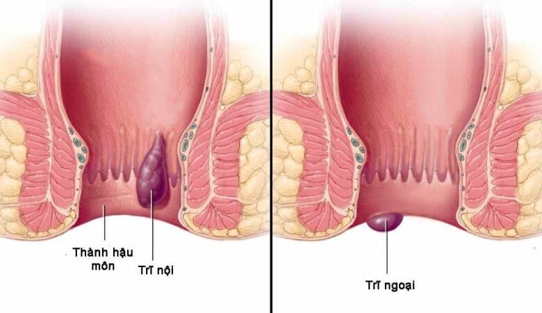 Hậu môn và các bệnh lý liên quan - YouMed