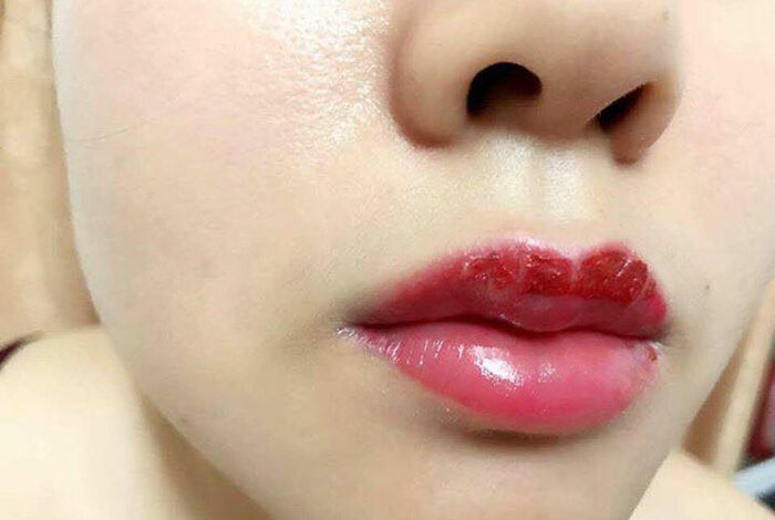 PHUN MÔI BAO LÂU THÌ BONG? BAO LÂU THÌ LÊN MÀU ĐẸP?