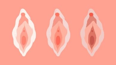 Bài tập Kegel cho “cô bé” lấy lại tuổi xuân nhanh chóng | Medlatec