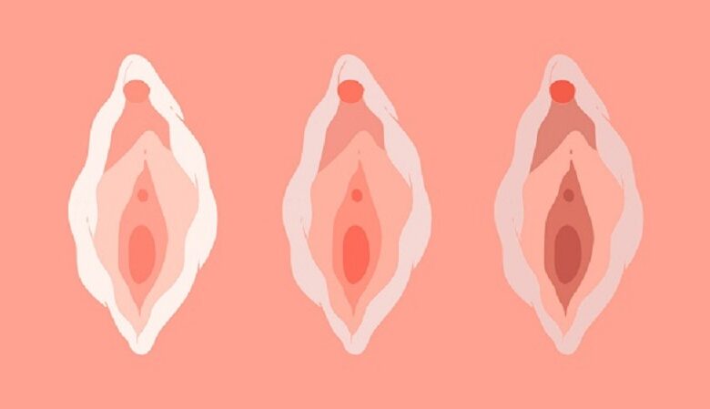 Bài tập Kegel cho “cô bé” lấy lại tuổi xuân nhanh chóng | Medlatec