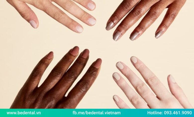 10+ màu nail tôn da 2023 - Be Dental - Nha khoa BeDental