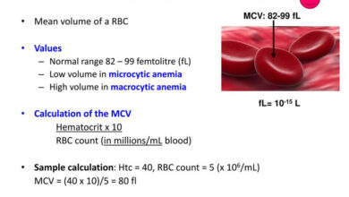 MCV là gì - Chỉ số này có ý nghĩa gì trong xét nghiệm máu