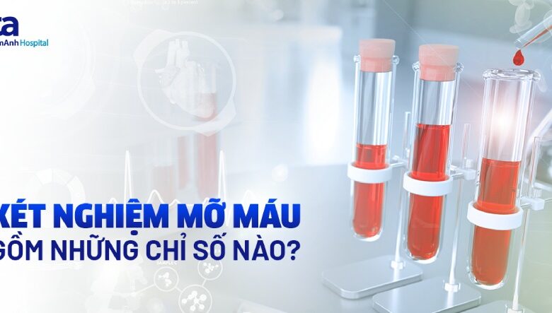 Xét nghiệm mỡ máu là gì? Gồm những chỉ số nào?