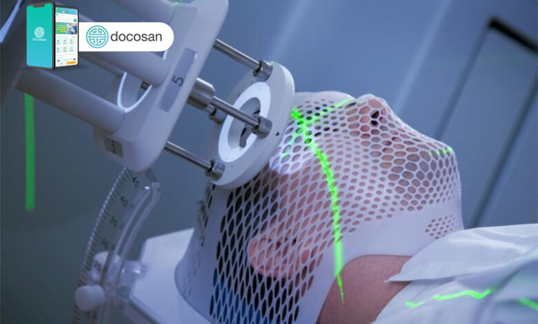Chi phí xạ trị điều trị ung thư mỗi lần là bao nhiêu tiền? - Docosan