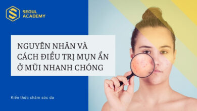 Cách trị mụn ẩn ở mũi & có mùi hôi, nguyên nhân & cách điều trị