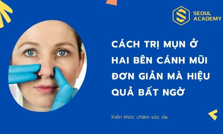 Cách trị mụn ở hai bên cánh mũi đơn giản mà hiệu quả bất ngờ