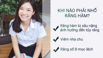 Nhổ Răng Hàm Bao Nhiêu Tiền? - Nha Khoa Parkway