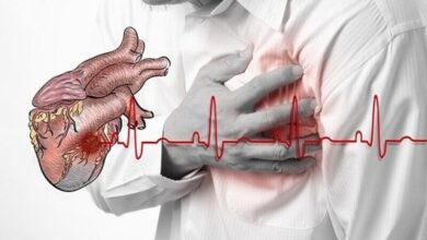 Nguyên nhân nhồi máu cơ tim và dấu hiệu nhận biết điển hình