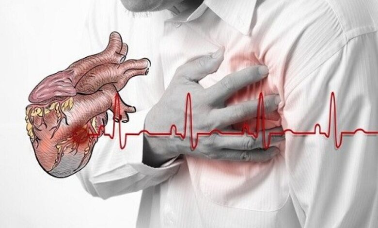Nguyên nhân nhồi máu cơ tim và dấu hiệu nhận biết điển hình