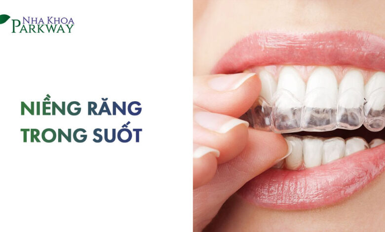Niềng răng trong suốt giá bao nhiêu? Bảng giá chi tiết