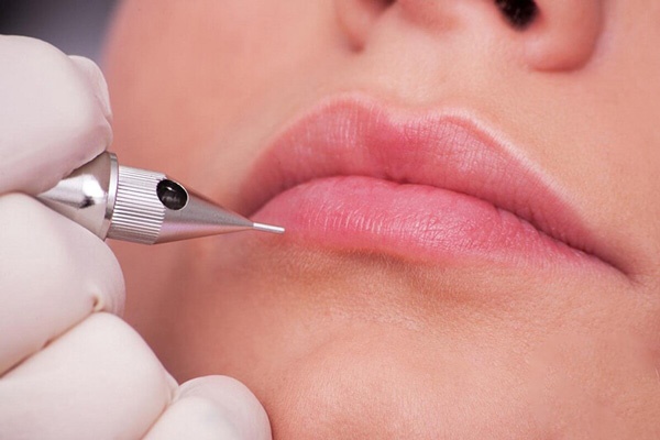 Phun môi xong bị nứt chảy máu: Liệu có đáng lo ngại?