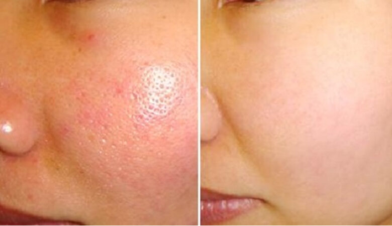 Lợi ích rửa mặt bằng nước ấm, khi nào nên rửa mặt bằng nước ấm?