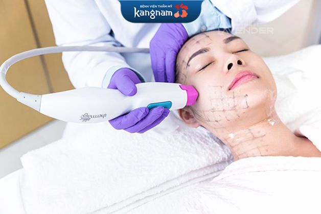 Công nghệ Thermage FLX là gì? Có tốt không? Giá bao nhiêu?