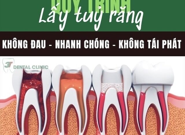 Trám Răng Sâu Lỗ To Được Không & Trám Răng ... - Nha Khoa 3T