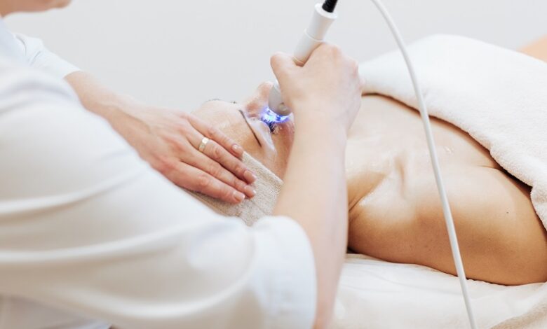 Tiết lộ trị nám bằng laser với những điều ít ai biết