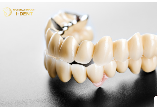 Bọc Răng Sứ - Giá Bao Nhiêu? Tìm Hiểu Mức Giá Tại Trường Trung Cấp Việt Hàn (VKI)