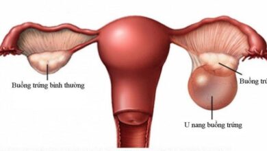 U nang buồng chứng có nguy hiểm không?