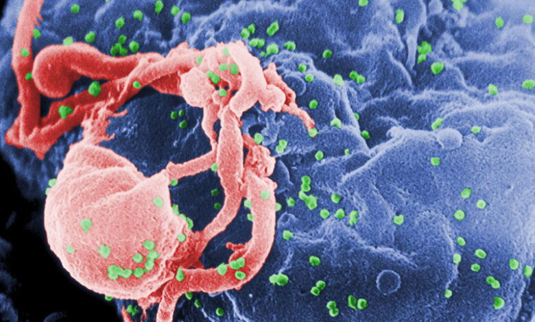 Xét nghiệm HIV hết bao nhiêu tiền và những thông tin cần biết