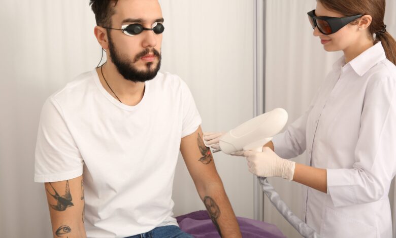 Xóa xăm laser có để lại sẹo không? - Hello Bacsi